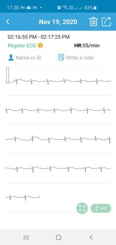 bp02 ecg