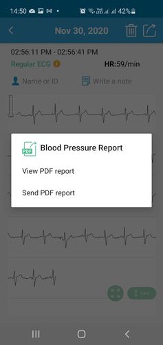 bp02 ecg list