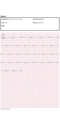 bp02 ecg